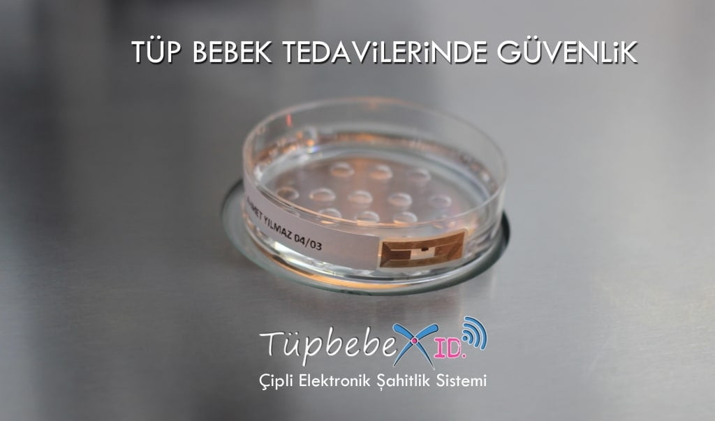 TupbebeX ID Nedir?