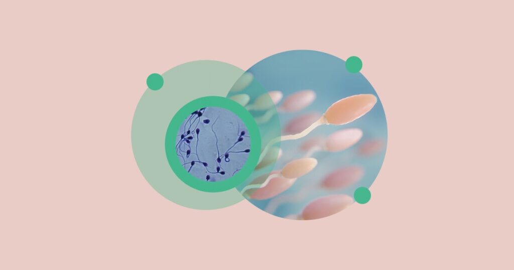 Tüp Bebek Tedavisinde En İyi Sperm Seçme Yöntemleri